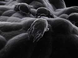 What are Dust Mites